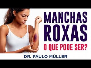 Manchas Roxas na Pele, O Que Pode Ser? – Dr. Paulo Müller Dermatologista.