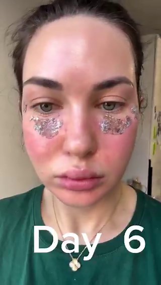 صانعة محتوى تشارك متابعينها طريقة تنظيف وتلميع بشرة وجههالكن السؤال اللي محيّر الكل: وش استخدمت بالضبط يا بنات؟ 🤔✨