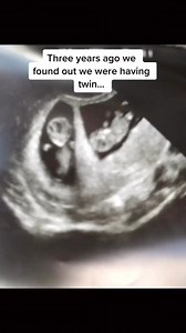 1.6M views · 43K reactions | One year ago today we found out the...