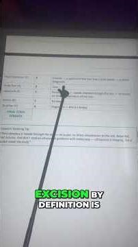 ICD-10-PCS Approach, Values, and Root Operation | Quick Coding Short