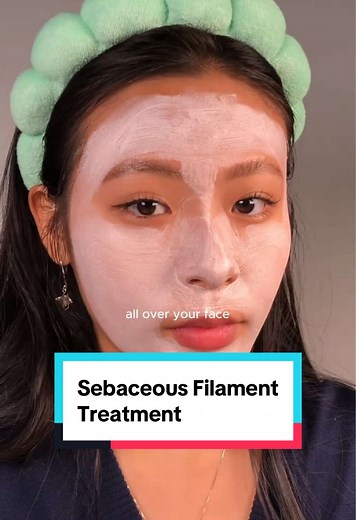Understanding Sebaceous Filaments: Care Tips for Oily Skin