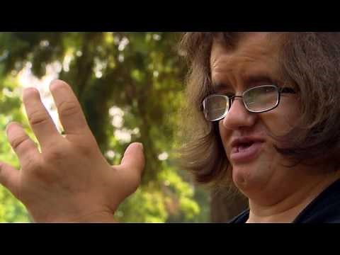 Local woman shares story of living with Coffin Siris Syndrome