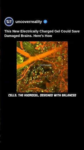This Electrically Charged Gel Could Save Damaged Brains. Here's How #brain #tech #shorts #medical