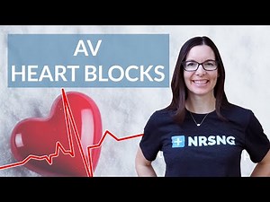 How to interpret AV Heart Blocks on an EKG strip