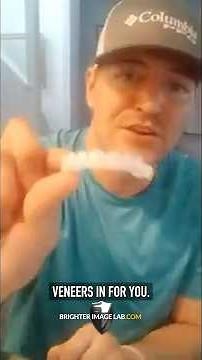 Do Snap-On Veneers Really Work? Watch My Honest Review!