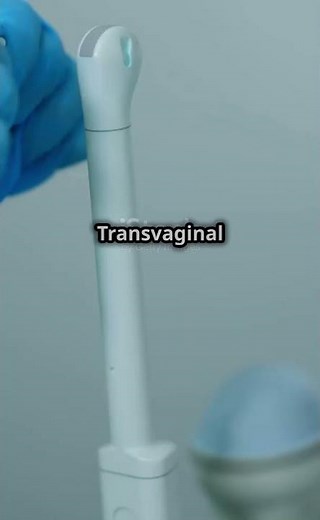 Ultrasound in OBGYN: A Quick Guide! #Ultrasound #OBGYN #PregnancyCare #WomenHealth #MedicalInsights