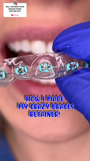 Crafting My Unique Braces Retainer Process