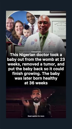Dr. Oluyinka O. Olutoye (originally from Nigeria) and Dr. Darrell Cass of Texas Children’s Hospital led a team that performed fetal surgery on a 23-week-old fetus. The fetus, named Lynlee Hope, had a sacrococcygeal teratoma (a type of tumor that arises where the tailbone is) which was threatening her health — it was diverting blood flow and causing risk of heart failure. During the surgery, portions of the fetus were removed from the womb, the tumor was excised, and the fetus was returned to the