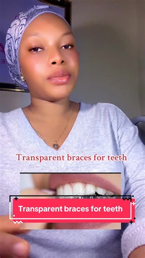Transparent Braces: A Smile Transformation Journey