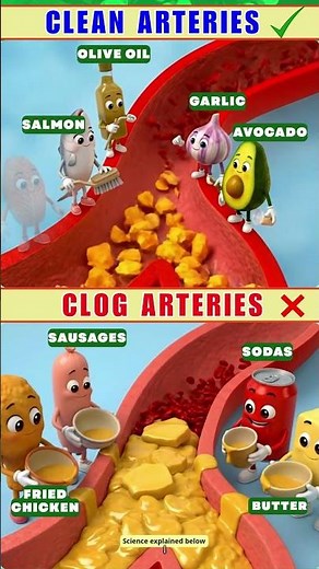 Clogged Arteries? These Foods May Help Support Blood Flow & Foods That May Contribute to Blockages