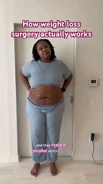 How a gastric sleeve works #weightlossjourney #weightlosstransformation #weightlossbeforeandafter