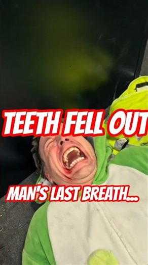 Man's TEETH KNOCKED OUT on ice skating ring #accident #fall #breakingnews #whiplash #crackingbones