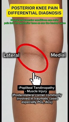 Baker's Cyst: A fluid-filled sac behind the knee, often causing swelling and discomfort.