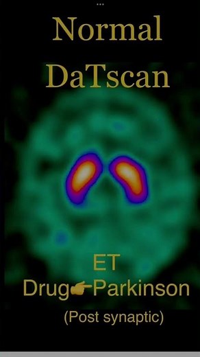 DaTscan