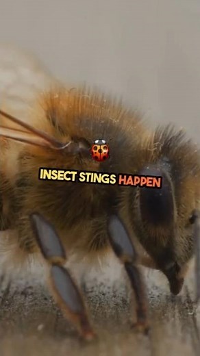 What Are The TOP Causes of Insect Sting? #bug #animals