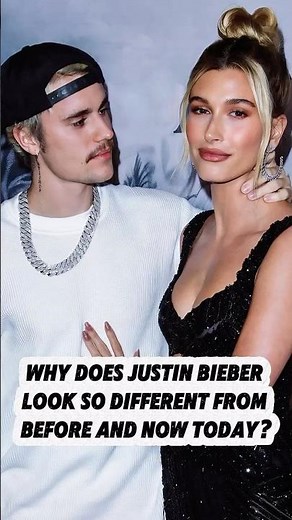 Why does Justin Bieber look so different from before and now today?#justinbieber #different #fypシ