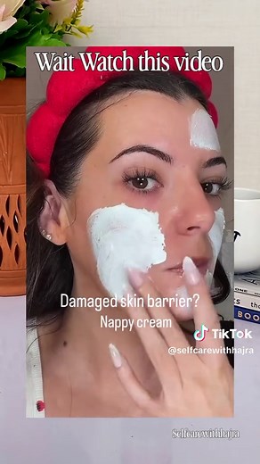 Honest Review of Sudocrem Antiseptic Healing Cream