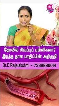 தோலில் சிவப்புப் புள்ளிகளா? இரத்த நாள பாதிப்பின் அறிகுறி! | #SkinHealth #DiabetesAwareness #Shorts