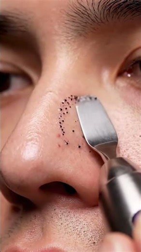 Soft Pore Cleaning ASMR - Clear Skin #asmr