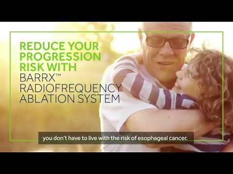 Treatment for Barrett's esophagus with Barrx™ Radiofrequency Ablation System