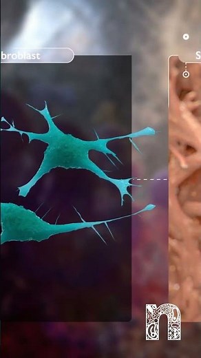 How MagnetOs can help you achieve a more predictable fusion | Medical Animation | MoA Animation