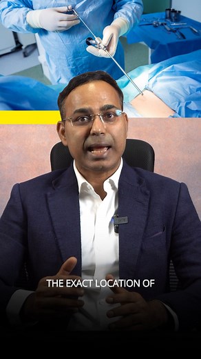 64K views · 150 reactions | Endoscopic spine surgery uses a tiny...