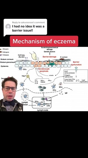 Understanding Eczema: Causes and Treatment Explained