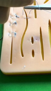 80K views · 708 reactions | Inverting horizontal mattress suture | Dermhacks | Facebook