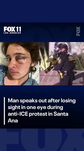 FOX 11 Los Angeles on Instagram: "A man protesting against ICE raids and the Renee Good shooting says he's now blind in one eye after he got shot by a federal officer in Santa Ana. The man's doctors are trying to get a hold of DHS to see what type of material got into Kaden's skull."