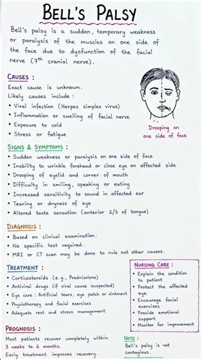 ‪@Nursepedia360‬ About BELLS PALSY #nursingstudent