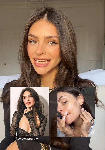 #curologypartner the 30 day before and after is CRAZY! Curologys newest launch DayPrime Rx, the first ever 2-in-1 acne treatment and primer. Start your @Curology journey today and get a special offer on your first box at the link in my bio! Subscription required, subject to consultation & restrictions apply. See website for full details and important safety information #DayPrimeRx #makeuphack #skincareproducts
