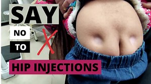 2-سال سے چھوٹے بچوں میں ہپس پر بار بار ٹیکے لگوانے کے نتائج!!! This video is for parental education. We should avoid repeated Hip injections in children. YouTube: https://youtu.be/6B8NIW2oylw Instagram: https://www.instagram.com/tv/CZE487alBMS/?utm_medium=copy_link | Dr. Rizwan Gohar - Child Specialist - Pediatrician