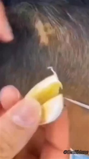 @coachcarl_health on Instagram: "😩 Noticing more hair in your brush lately? 💇‍♀️ Hair thinning starts when hair follicles weaken or become clogged. Your scalp, like soil, needs nourishment and oxygen to grow strong strands. Garlic works by improving blood flow to your follicles, delivering essential nutrients directly where they’re needed most. Coconut oil and honey then step in as the “moisture team,” sealing hydration and protecting those fragile roots. 🔬 Why does it work? Garlic is rich in