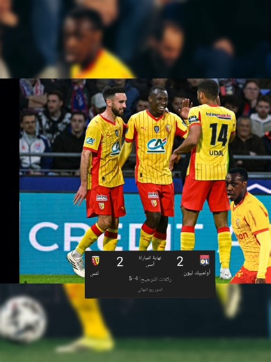 ملخص ماقدمة اليوم سعود عبدالحميد مخلص مبارة أولمبيك ليون ضد لنس 5_4 lyon vs lens #سعود_عبدالحميد #saudabdulhamid #lyon #lens #fyp