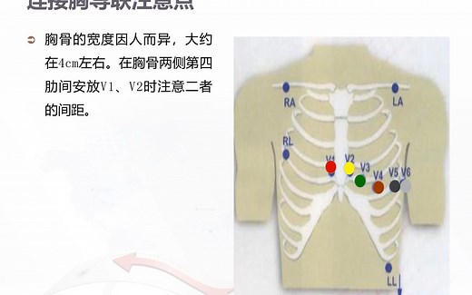 心电图机的操作流程及心电监护仪的使用PPT