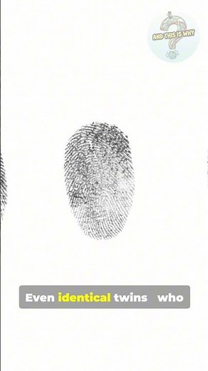 And This Is Why Fingerprints Are Unique 🖐️ | Science Explained
