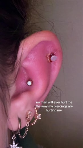 Understanding the Pain of Surface Piercings