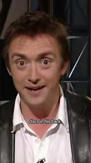 Jeremy Clarkson's Mistake Changed his Life - Injuries You ACTUALLY See on Top Gear