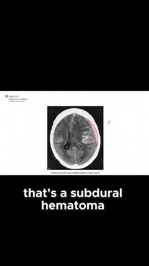 USMLE Step 1 High Yield | First Aid Rapid Review Facts You Must Know