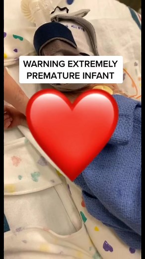 12K views · 178 reactions | His first cry ever.. #nicu #strong #micro #preemie #babyboy #fypシ | Nicu baby | Facebook
