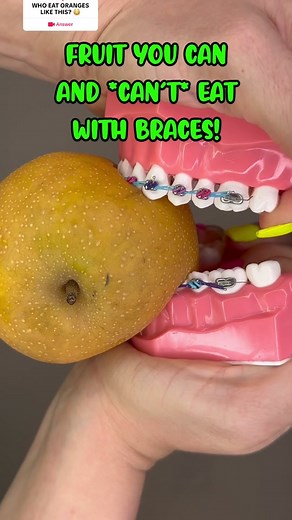 #question from @bracesbybritt ANYONE EAT ORANGES LIKE THIS? 🍊😂 #braces #foodasmr #fruit
