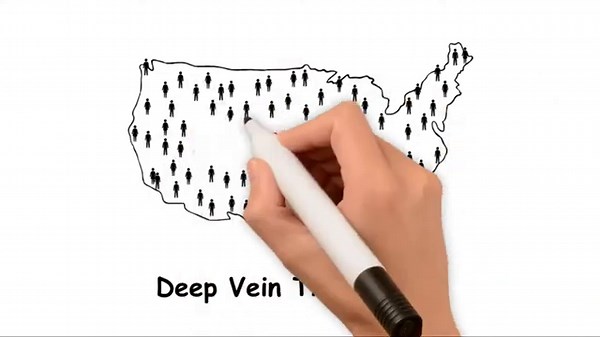 PlasmaFlow by VenaLife