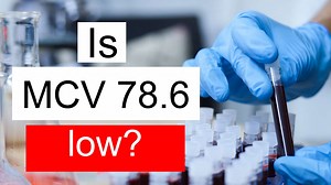 Is MCV 78.6 low, normal or dangerous? What does Mean corpuscular volume level 78.6 mean?