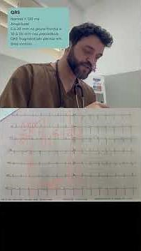 Como identificar um QRS normal?