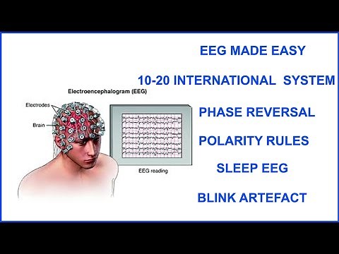 EEG MADE EASY