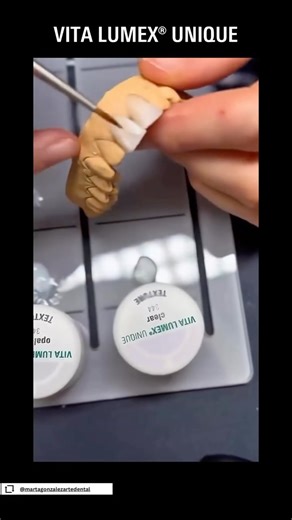 VITA Zahnfabrik on Instagram: "Before the weekend begins, we wanted to share this beautiful case from our community. Following the holiday period, our Friday community case features have finally returned! 👏 This beautiful work shows what’s possible with our products VITA LUMEX® UNIQUE and our VITA VACUMAT® 6000 MP! Have you worked with these VITA products already? We’d love to hear about your experience! Feel free to share your work with us and tag us when using VITA products - You may be featu