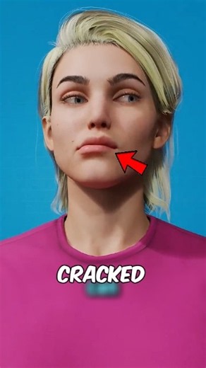 Why Does Your Tongue Have Cracks? 😱👅