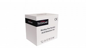 [Hot Item] Molecular Diagnosis Test Monkeypox MPV Nucleic Acid Real-Time PCR Kit