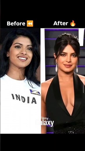 Your favorite celebs with their before surgery and after surgery looks 😍❤️