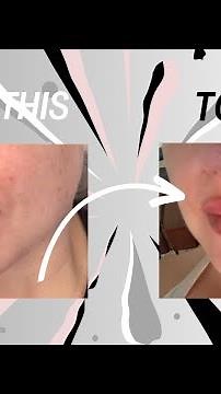 Before and After using Eucerin Hyaluron Filler and Elasticity range #eucerin #antiaging